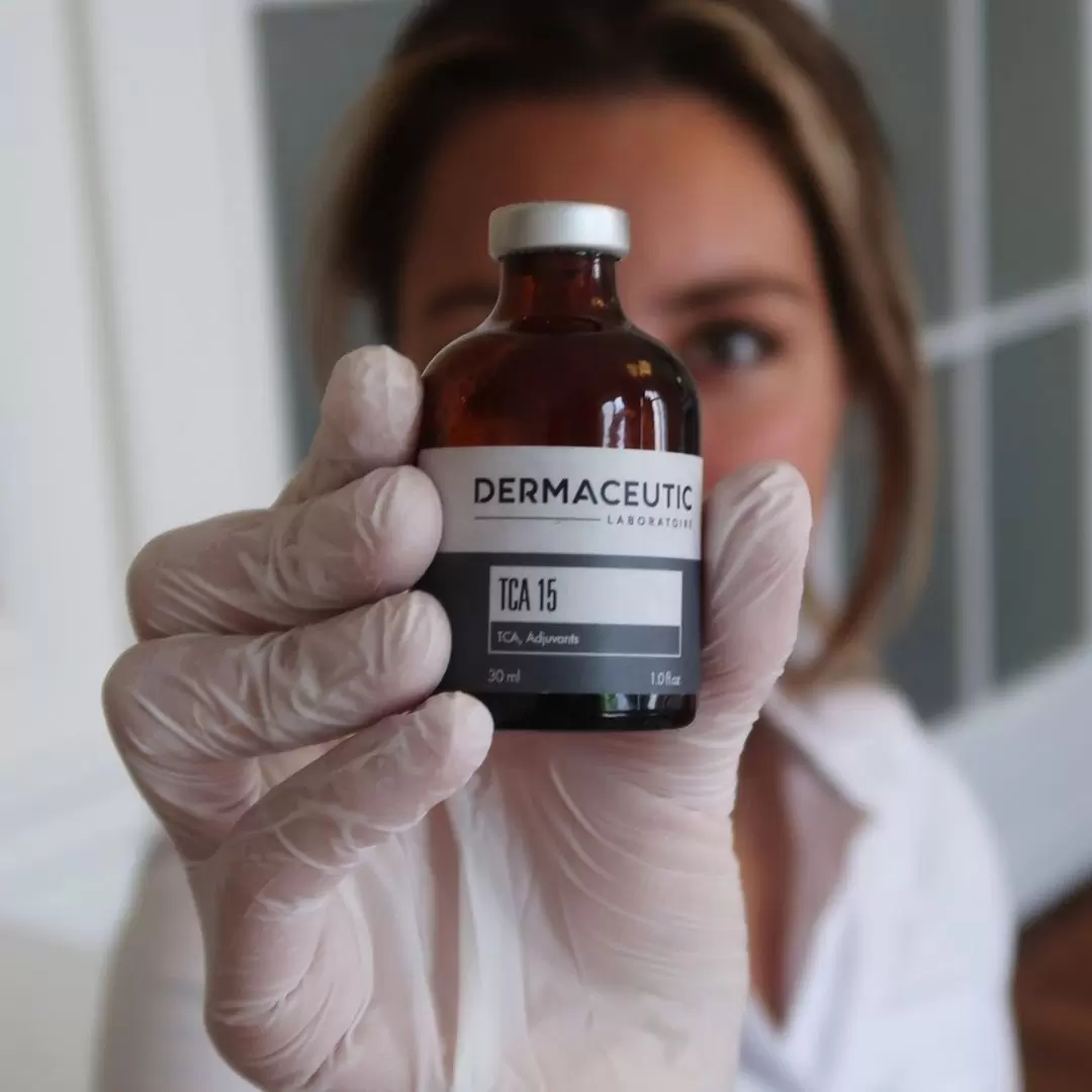 chemische peeling